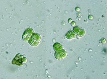 Apatococcus lobatus