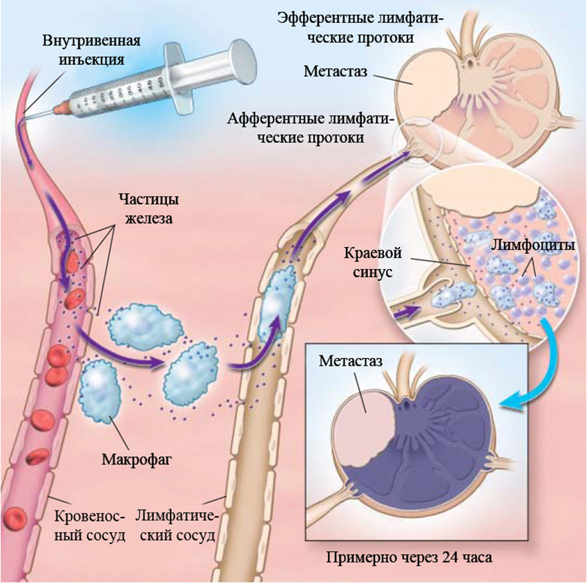 Схема переноса наночастиц оксида железа в лимфатическую систему
