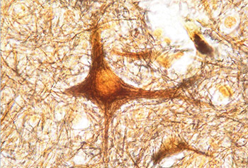 Нервная клетка (нейрон)