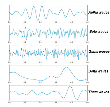 Рис. 2. Пять видов электроэнцефалограмм