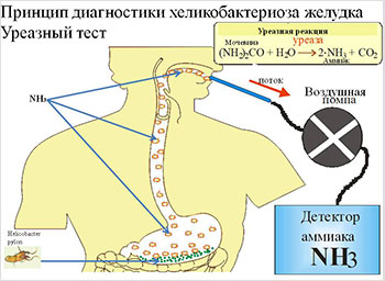 Принцип диагностики Helicobacter pylori Принцип диагностики