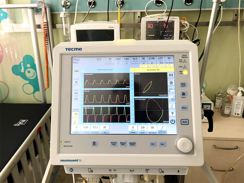 Так выглядят дисплеи современных аппаратов ИВЛ